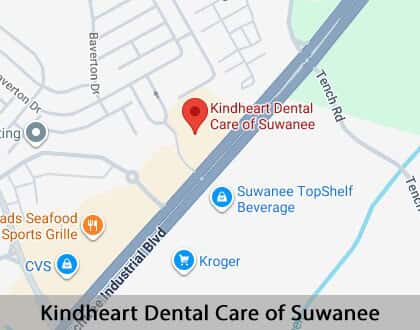 Map image for Options for Replacing Missing Teeth in Suwanee, GA