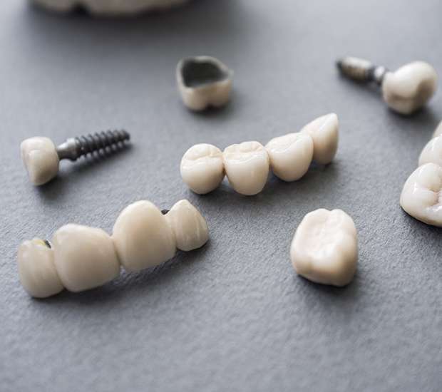 Suwanee The Difference Between Dental Implants and Mini Dental Implants